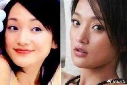 大小眼明星,揭秘明星眼中的世界差异